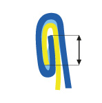 Đo chiều cao chồng mí